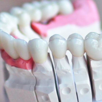 Crowns and bridges dental prosthesis dental crown | DR. HAGER