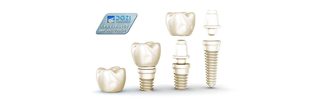 Ceramic Implants - Implantation Systems - Dental Implants | Dr. HAGER